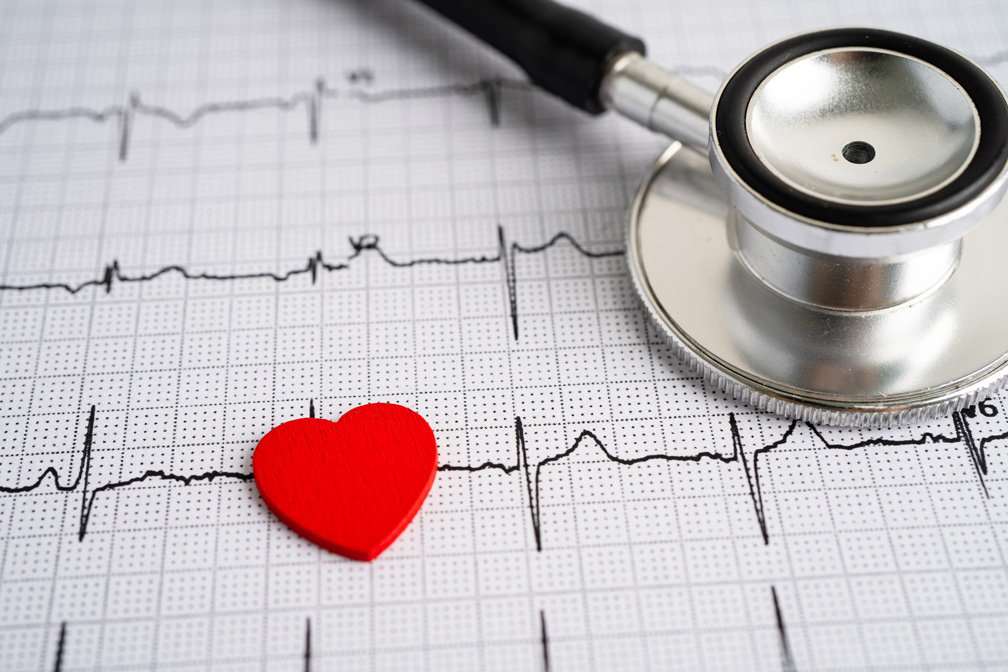 Stethoscope on electrocardiogram ECG with red heart